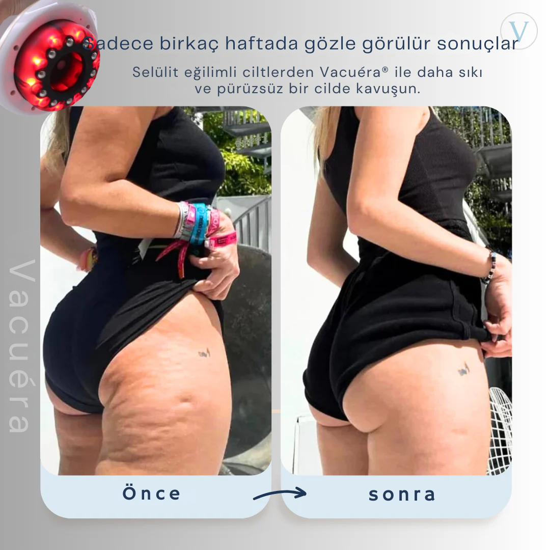 Vacuéra®- Daha sıkı, daha tonlu bir cilt
